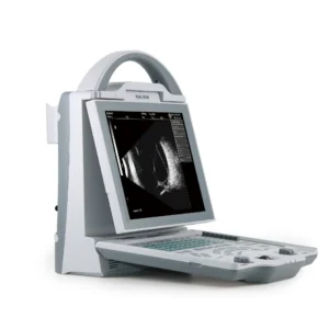 A/B-Scan Ophthalmic Ultrasonography ASP-100AB